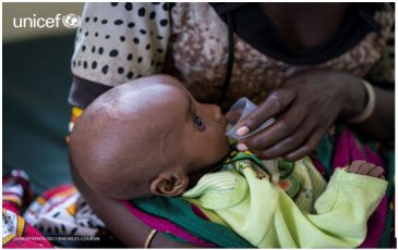 A child suffering from severe acute malnutrition receiving therapeutic milk at UNICEF-supported clinic in Loiyangalani, Marsabit County in Kenya. UNICEF in collaboration with partners is responding to the drought by providing urgently needed therapeutic feeding supplies. ©UNICEF
