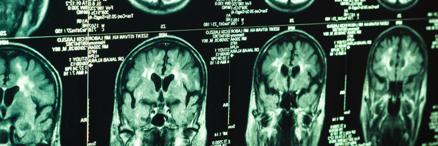 Investment Plan for Europe: EIB backs German cancer therapy developer MagForce