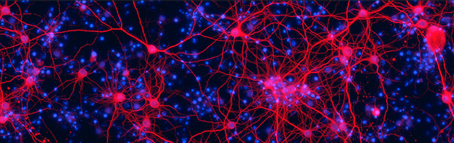 Japan to join multinational neuroscience research project