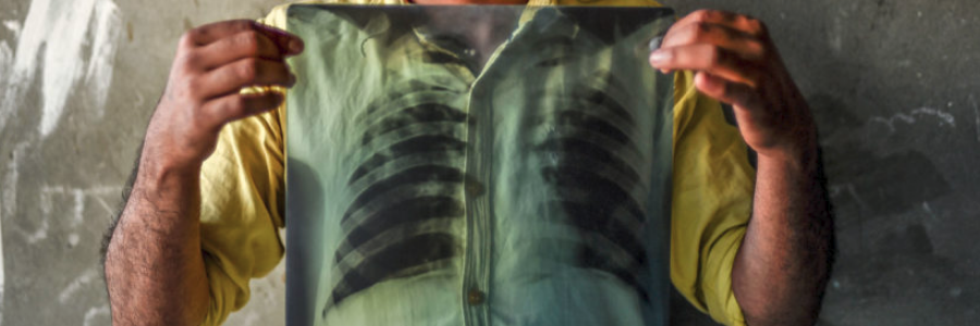 IFRC and partners advocate to stop tuberculosis epidemic IFRC and partners advocate to stop tuberculosis epidemic