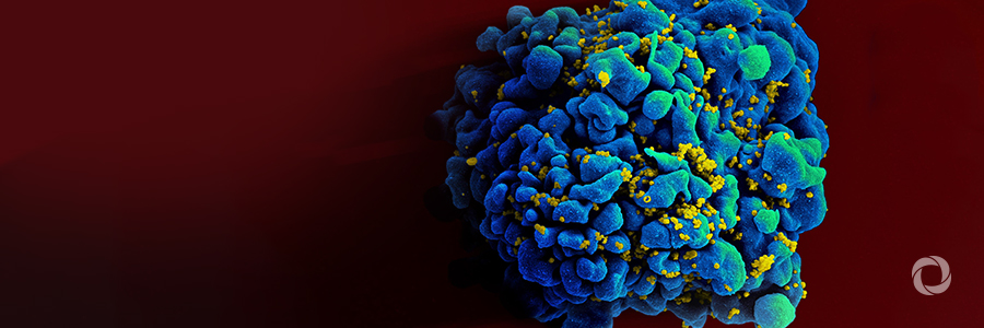 Healthy competition intensifies 30-year quest for HIV vaccine Healthy competition intensifies 30-year quest for HIV vaccine