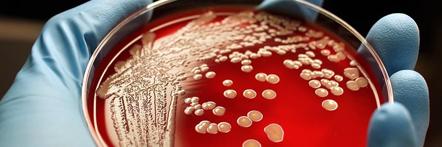 £30 million of funding to tackle antimicrobial resistance £30 million of funding to tackle antimicrobial resistance