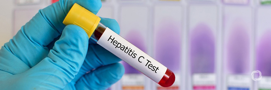 Action needed to find, test, treat millions unknowingly infected with viral hepatitis Action needed to find, test, treat millions unknowingly infected with viral hepatitis