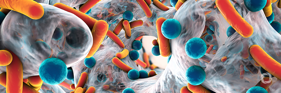 Antimicrobial resistance is a global threat Antimicrobial resistance is a global threat