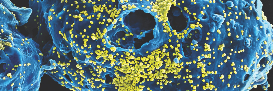 DFAT supports the fight against epidemics DFAT supports the fight against epidemics