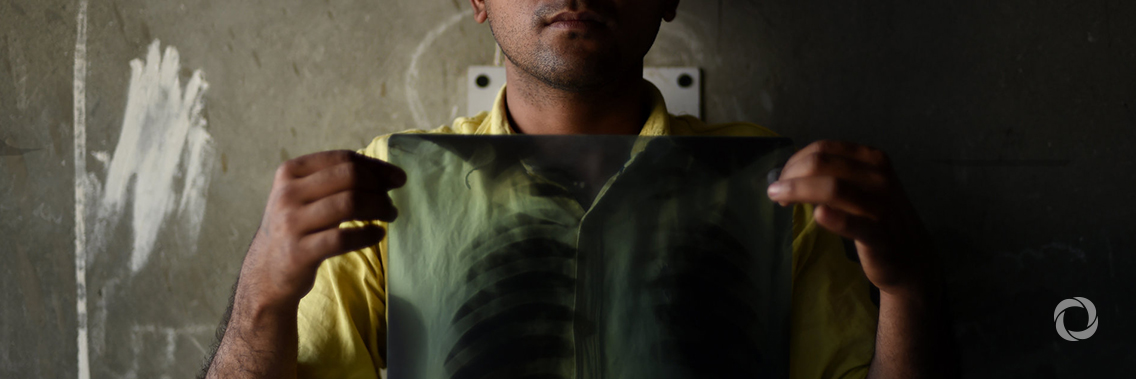 Significant progress achieved against TB in high-burden Asian countries Significant progress achieved against TB in high-burden Asian countries