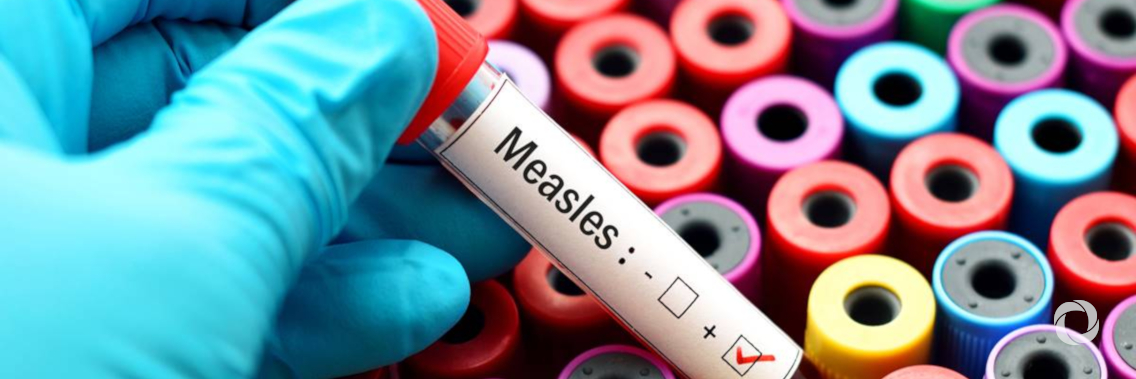 European Region loses ground in effort to eliminate measles European Region loses ground in effort to eliminate measles