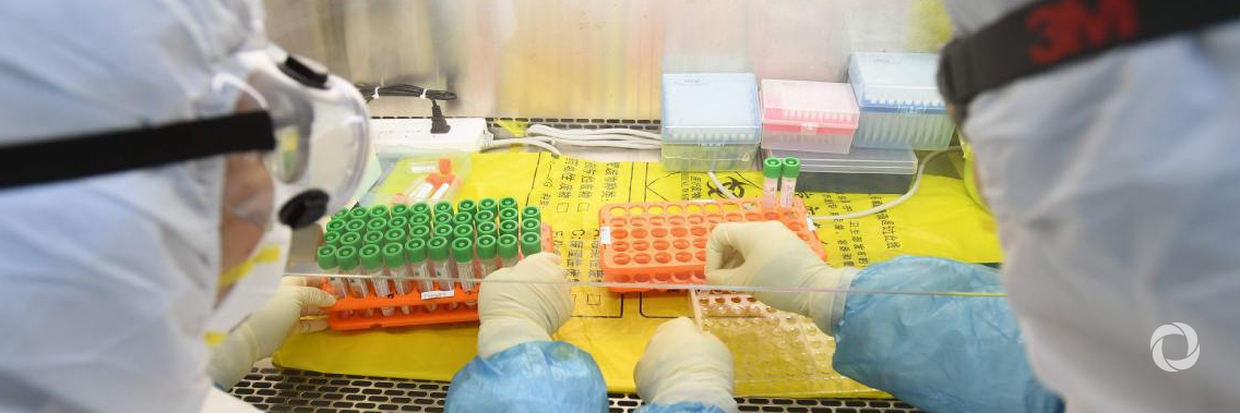 How is the COVID-19 virus detected using real time RT-PCR?