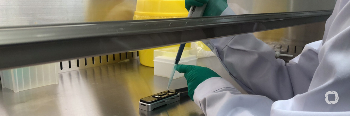 IAEA to support countries in the detection of novel coronavirus IAEA to support countries in the detection of novel coronavirus