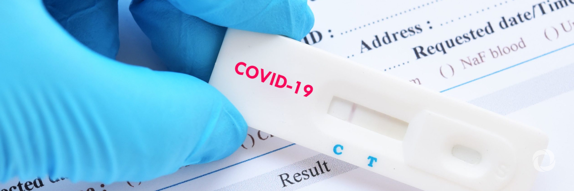 CABEI provides the region with 182,000 COVID-19 tests CABEI provides the region with 182,000 COVID-19 tests