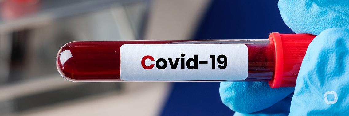 CABEI approves US$50 million to Honduras for prevention, detection and treatment of COVID-19 CABEI approves US$50 million to Honduras for prevention, detection and treatment of COVID-19