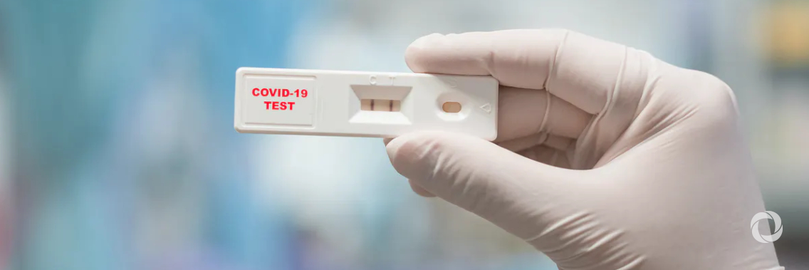 PAHO helped procure 10 million PCR diagnostic tests for COVID-19 for countries in Latin America and the Caribbean PAHO helped procure 10 million PCR diagnostic tests for COVID-19 for countries in Latin America and the Caribbean