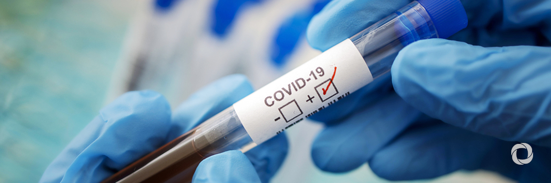 African Development Bank COVID-19 response grant is saving lives in South Sudan