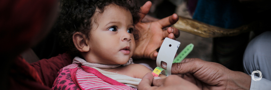UN findings on malnutrition in Yemen raise concerns over displaced children UN findings on malnutrition in Yemen raise concerns over displaced children