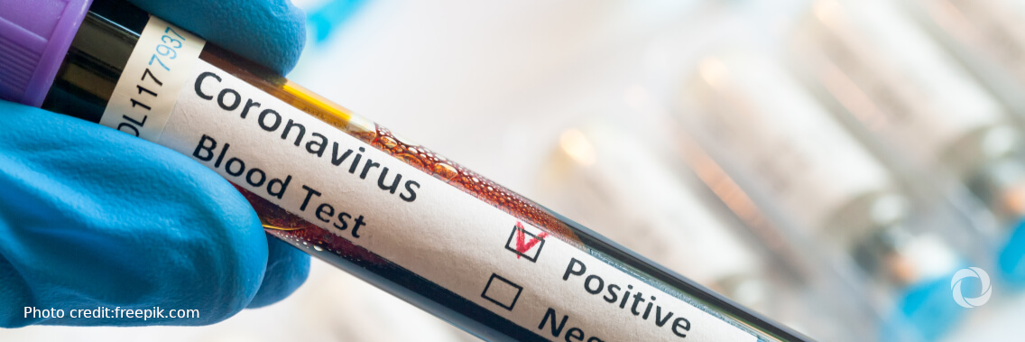 WHO warns of COVID-19 ‘tipping point’ as cases rise across Europe WHO warns of COVID-19 ‘tipping point’ as cases rise across Europe