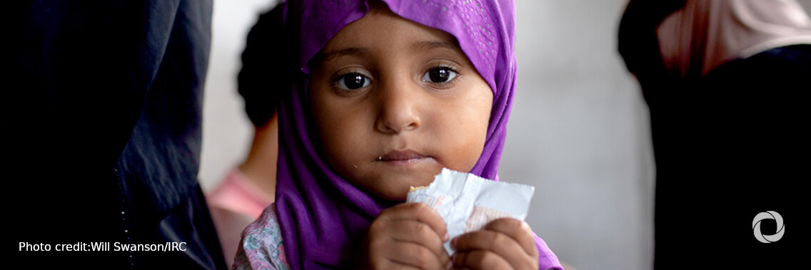 Acute malnutrition threatens half of children under five in Yemen in 2021: UN Acute malnutrition threatens half of children under five in Yemen in 2021: UN