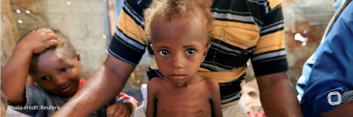 WFP Chief appeals for peace as Yemen teeters on edge of famine WFP Chief appeals for peace as Yemen teeters on edge of famine