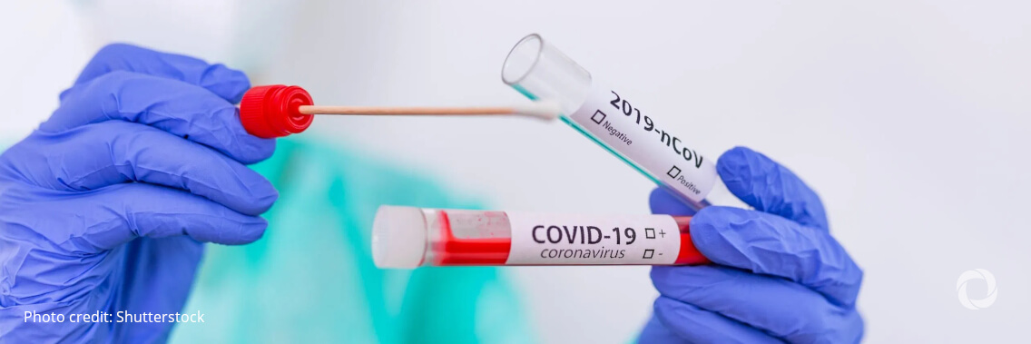 FIND and Unitaid invest to support technology transfer and boost local production of COVID-19 rapid tests in low- and middle-income countries