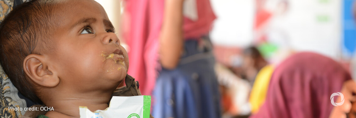 100,000 children in Tigray at risk of death from malnutrition: UNICEF