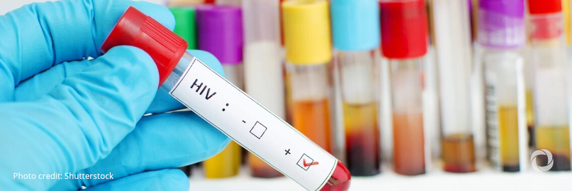 ASEAN cities protecting the gains of the HIV response during the COVID-19 pandemic