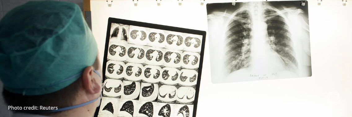 Impact of COVID-19 hits hard as TB deaths among people living with HIV rise for the first time since 2006