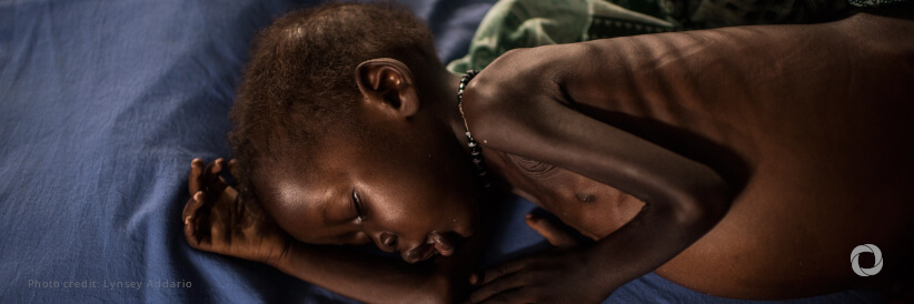 Italy provides new funding for tackling malnutrition in Sudan