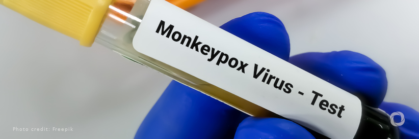 WHO is supporting African countries to strengthen monkeypox surveillance and response actions WHO is supporting African countries to strengthen monkeypox surveillance and response actions