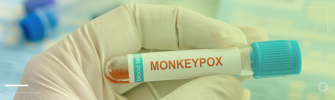 South Africa registers first case of monkeypox