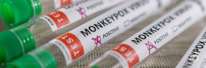 Monkeypox becoming established in non-endemic countries warns Tedros; calls for more testing, vaccines to end COVID pandemic Monkeypox becoming established in non-endemic countries warns Tedros; calls for more testing, vaccines to end COVID pandemic