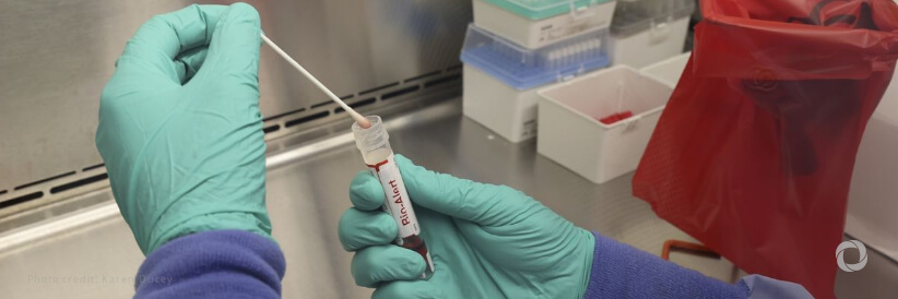 UNAIDS calls for urgent global response to Monkey Pox Public Health Emergency with rights-based public health and equitable access to vaccines UNAIDS calls for urgent global response to Monkey Pox Public Health Emergency with rights-based public health and equitable access to vaccines