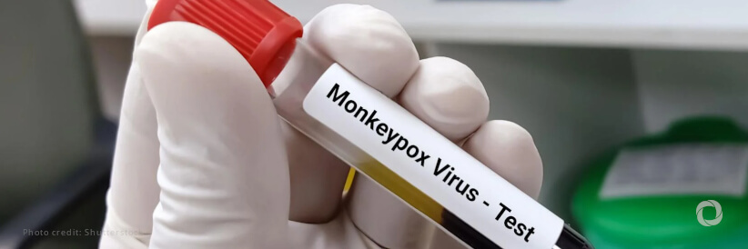 WHO: ‘We believe Monkeypox outbreak can be stopped’ WHO: ‘We believe Monkeypox outbreak can be stopped’