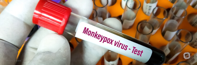 Monkeypox concern heightened after becoming a ‘northern’ disease, says WHO Monkeypox concern heightened after becoming a ‘northern’ disease, says WHO