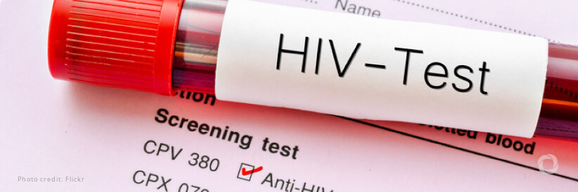 Unitaid issues call for proposals to help avert the most common causes of death among people living with HIV