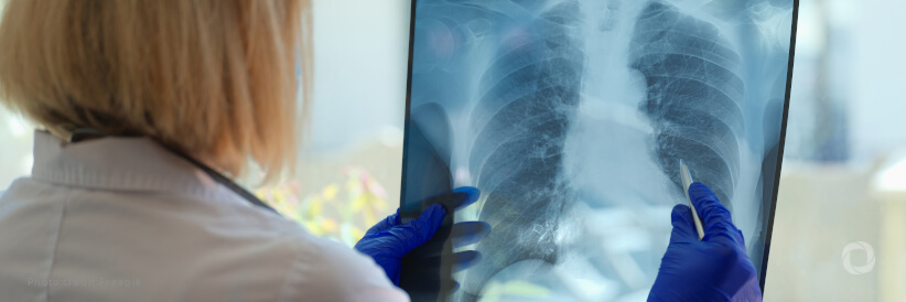 New World Bank financing aims to strengthen Indonesia's tuberculosis response program New World Bank financing aims to strengthen Indonesia's tuberculosis response program