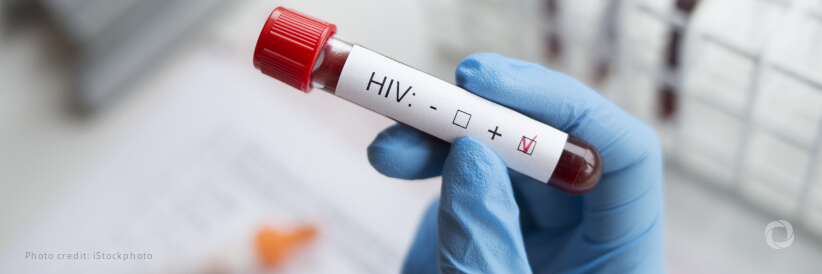 African ministers of finance join forces to highlight the importance of financial sustainability in the response to HIV African ministers of finance join forces to highlight the importance of financial sustainability in the response to HIV