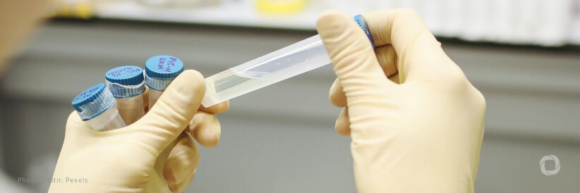 WHO prequalifies additional HPV test, expanding options as countries pursue cervical cancer elimination WHO prequalifies additional HPV test, expanding options as countries pursue cervical cancer elimination