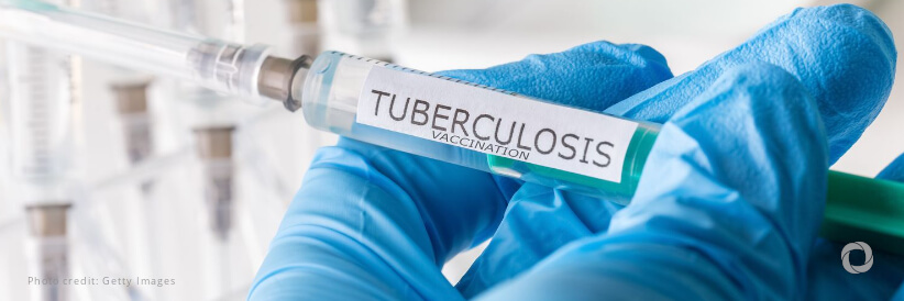 Wellcome and the Gates Foundation to fund development of a Tuberculosis vaccine that could be the first in 100 years if proven effective Wellcome and the Gates Foundation to fund development of a Tuberculosis vaccine that could be the first in 100 years if proven effective