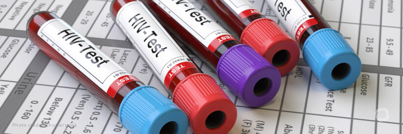 Global Fund, PEPFAR and Unitaid collaboration paves way to accelerate approval of African-Manufactured HIV rapid tests