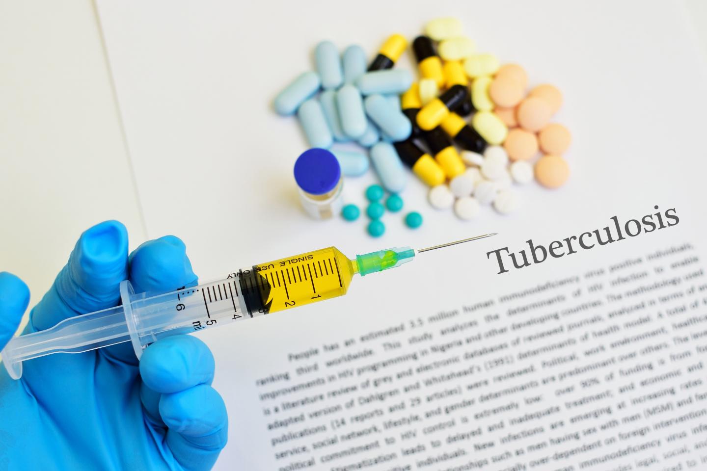 Global Fund and Siemens Healthineers to accelerate adoption of artificial intelligence for tuberculosis diagnosis Global Fund and Siemens Healthineers to accelerate adoption of artificial intelligence for tuberculosis diagnosis