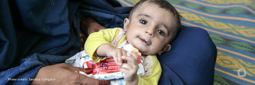 WHO issues new guideline to tackle acute malnutrition in children under five