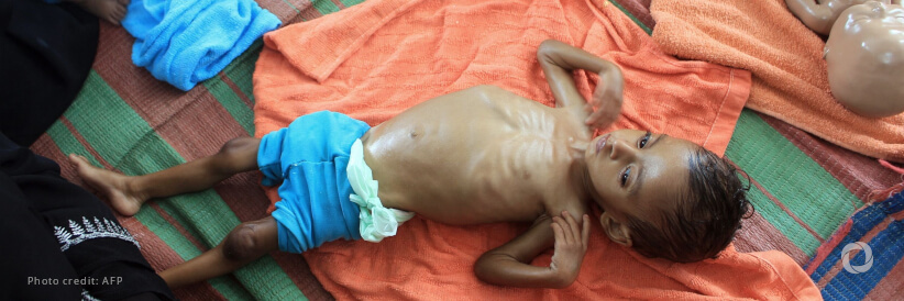 First-of-its-kind study reveals why some children relapse after being treated for severe acute malnutrition