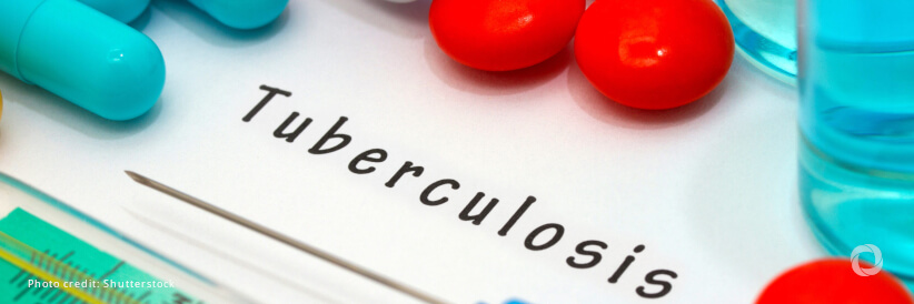 WHO announces forthcoming updates on tuberculosis preventive treatment