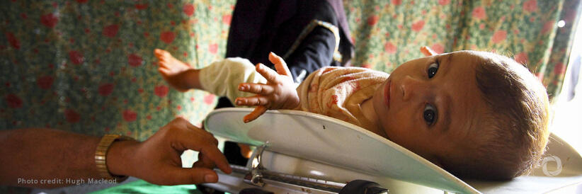 Acute malnutrition surges in Government of Yemen-controlled areas with extremely critical conditions reported in West Coast areas Acute malnutrition surges in Government of Yemen-controlled areas with extremely critical conditions reported in West Coast areas