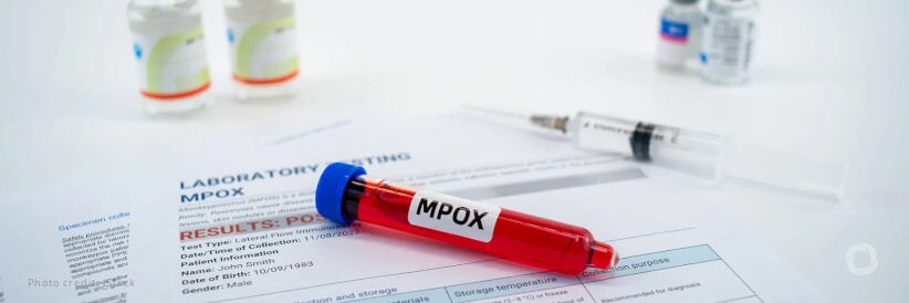 Countries of the Americas should strengthen Mpox surveillance in light of potential spread of new variant detected in African region, PAHO says