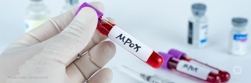 WHO seeks $135 million to defeat mpox