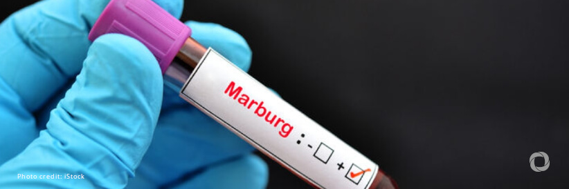 USAID mobilizes response to Marburg outbreak in Rwanda USAID mobilizes response to Marburg outbreak in Rwanda