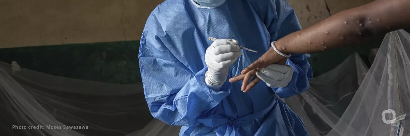 The Democratic Republic of the Congo kicks off mpox vaccination