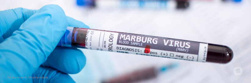 Tanzania confirms outbreak of Marburg virus disease