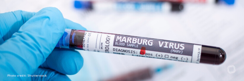 MSF team supports response to outbreak of Marburg virus in Tanzania MSF team supports response to outbreak of Marburg virus in Tanzania