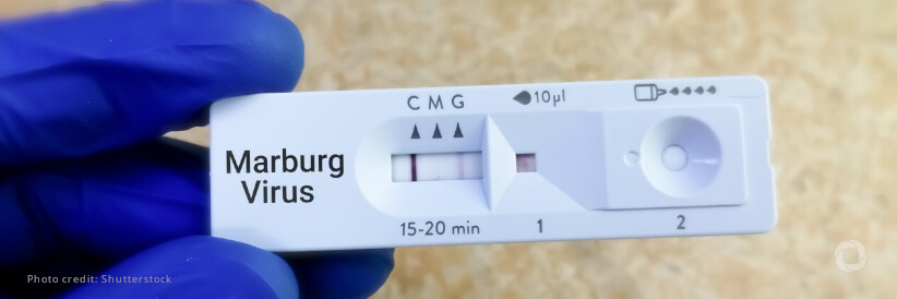 Tanzania declares end of Marburg virus disease outbreak